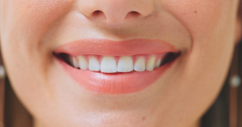 Sourire avec dents blanches et esthétiques - Soins de dentisterie esthétique Odontys