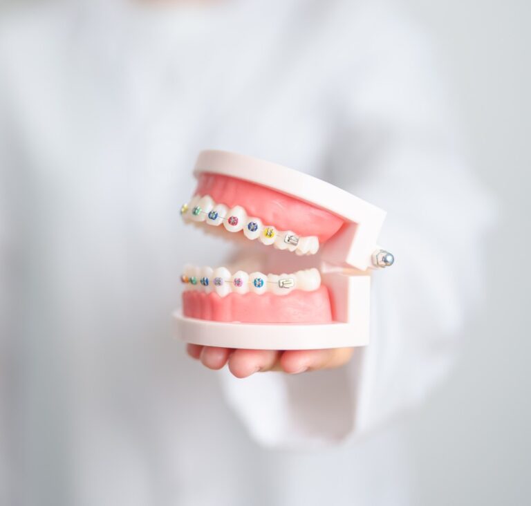 Modèle de mâchoire avec broches orthodontiques et élastiques colorés, illustrant une approche ludique et personnalisée du traitement