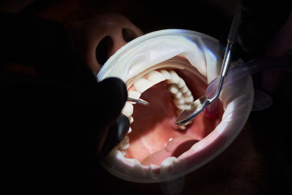 Examen buccal lors d’un traitement de réhabilitation de la fonction masticatoire