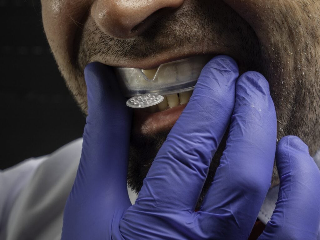 Homme portant une gouttière de blanchiment dentaire - Soins de dentisterie esthétique Odontys